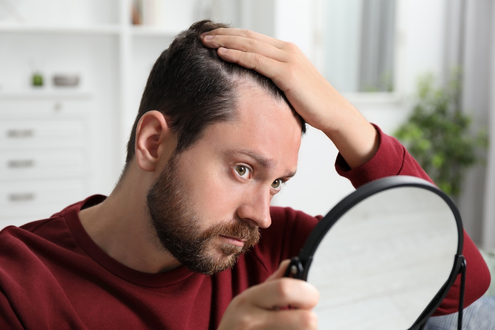 Understanding Hair Loss & The Causes